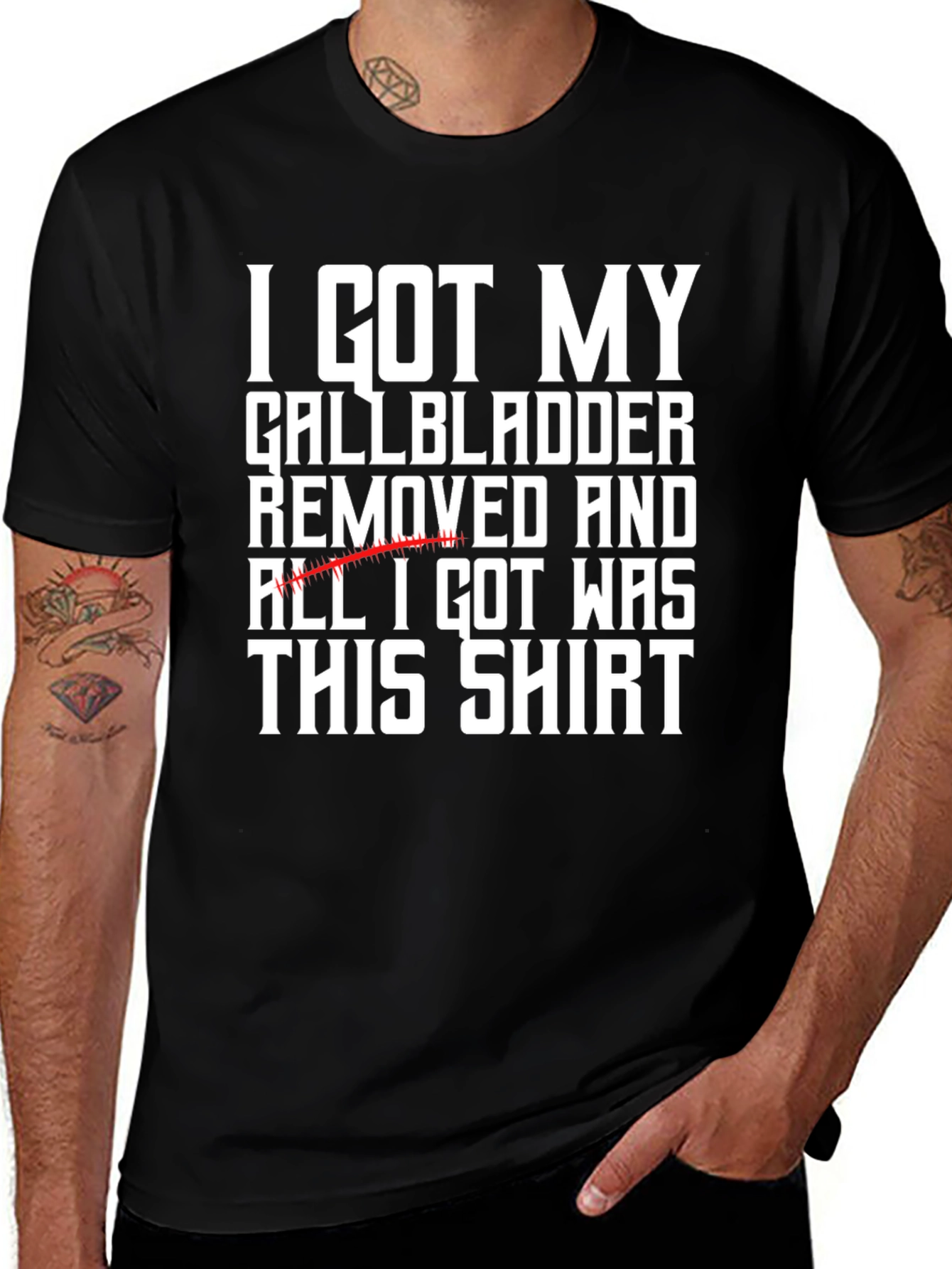 Gallbladder Removed Shirt Funny Get Well Gift Tee